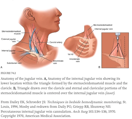 Anatomy of the internal jugular vein within the triangle formed by the sternal and clavicular heads of the sternocleidomastoid and the clavicle — needle entry point at the apex of the triangle
