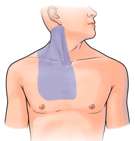 Patient supine with shaded prep zone extending from mandible to mid-chest including the entire ipsilateral neck