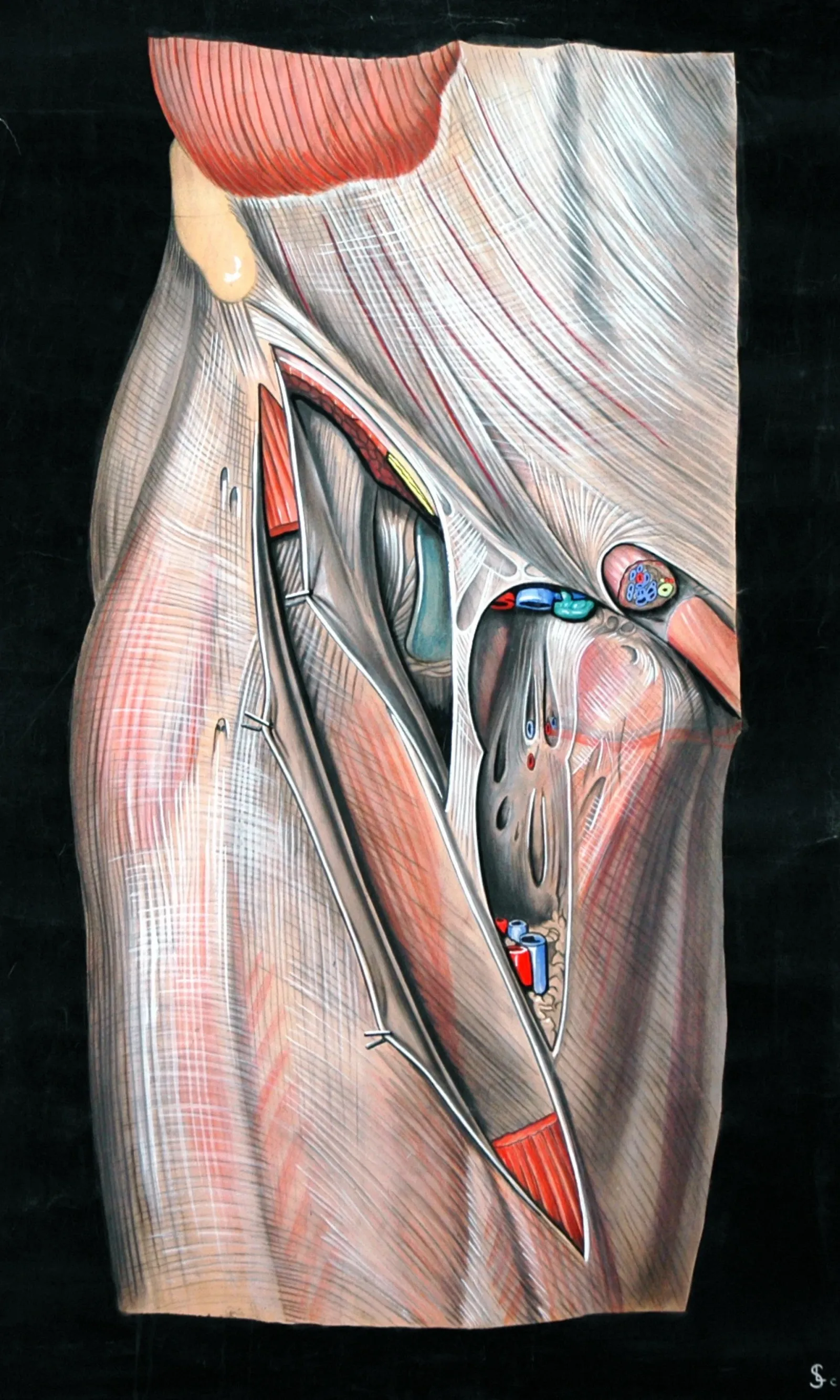 Cadaveric femoral triangle dissection