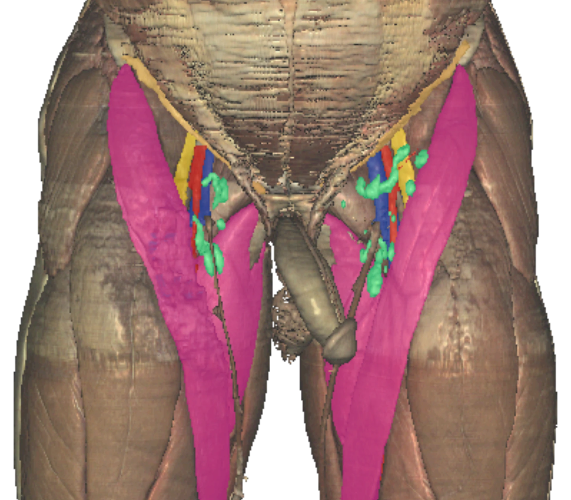 Femoral triangle contents — Nerve, Artery, Vein, Empty space (lymphatics), Lymph nodes (NAVEL) — lateral to medial relationship of the femoral vessels at the inguinal ligament