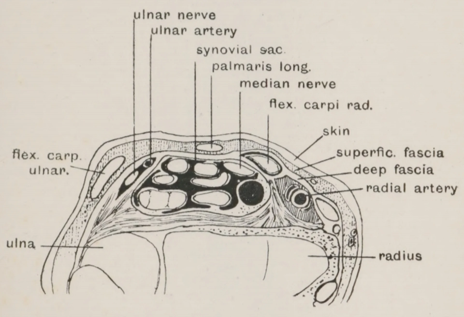 Classical anatomical engraving of the radial artery at the pulse groove at the distal wrist, between the flexor carpi radialis tendon medially and the distal radius laterally, with adjacent musculature