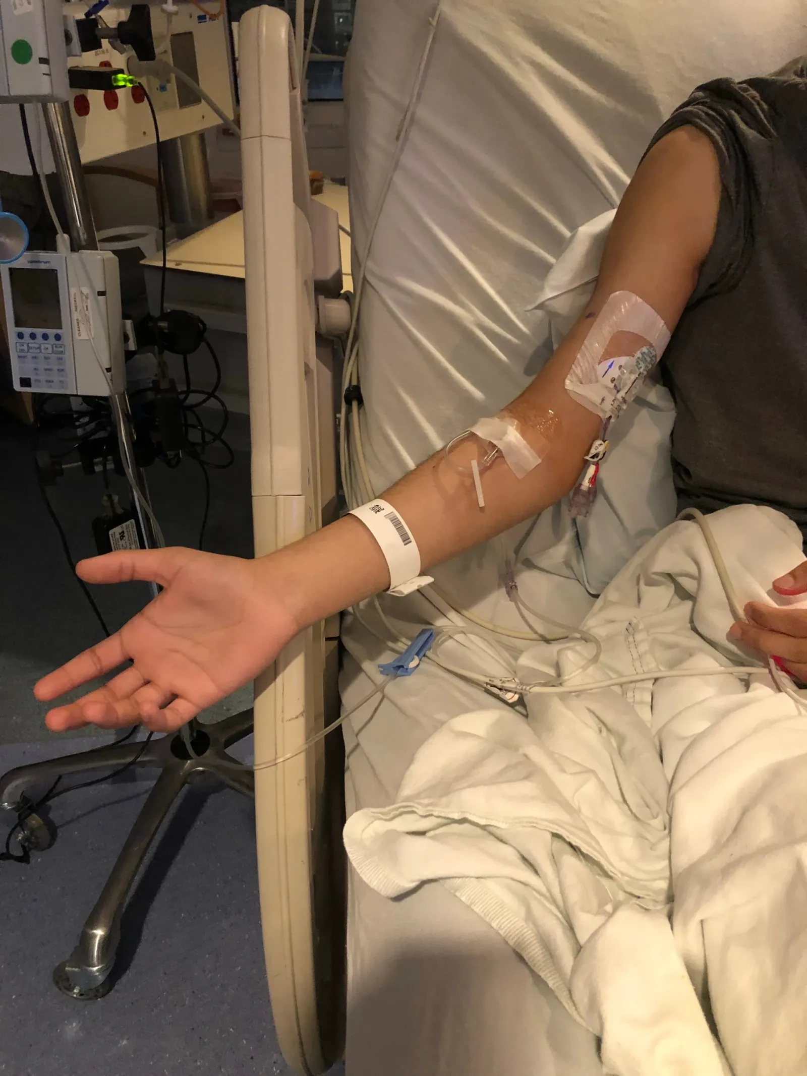 Clinical setting showing peripheral IV access alongside PICC site — context for escalation beyond landmark technique