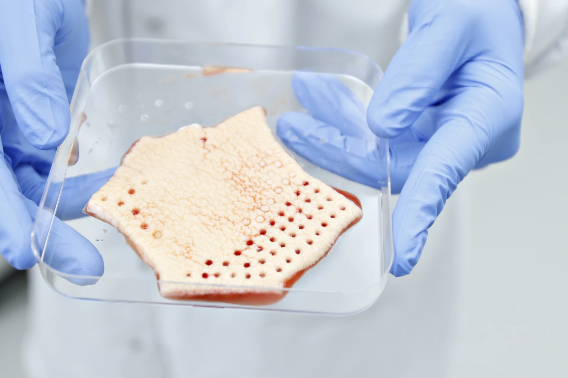 Human skin explant photographed after removal of multiple cylindrical punch-biopsy cores, showing full-thickness defects through epidermis, dermis, and subcutis
